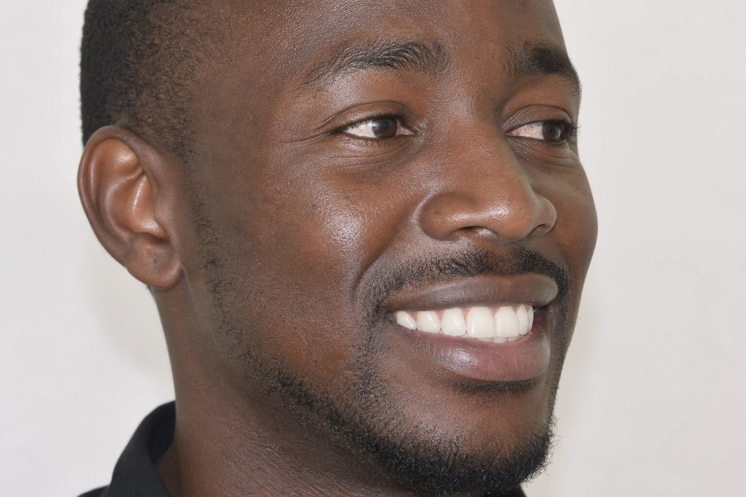 After — Single Dental Implant