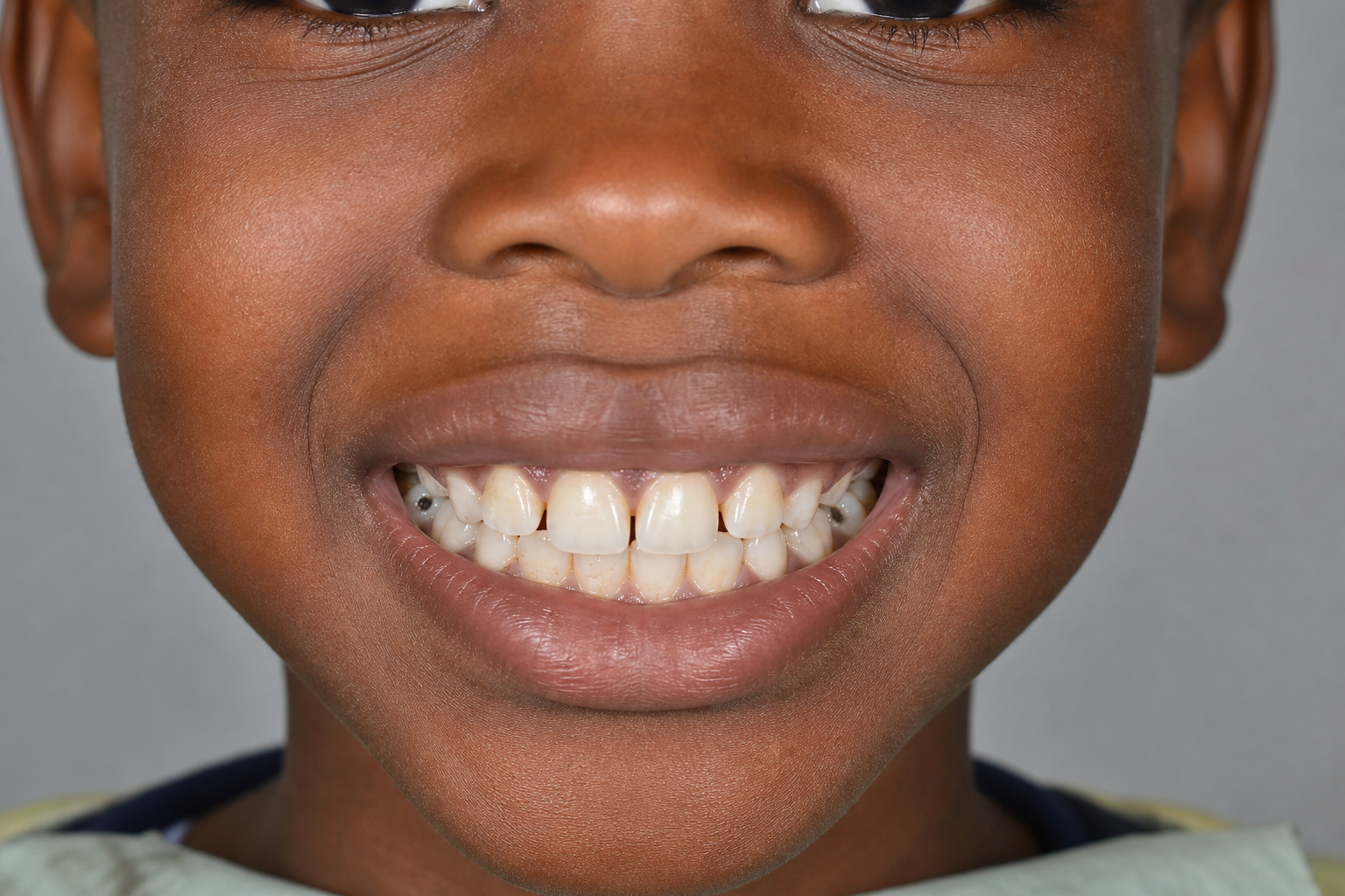 Paediatric Preventive Programme — before