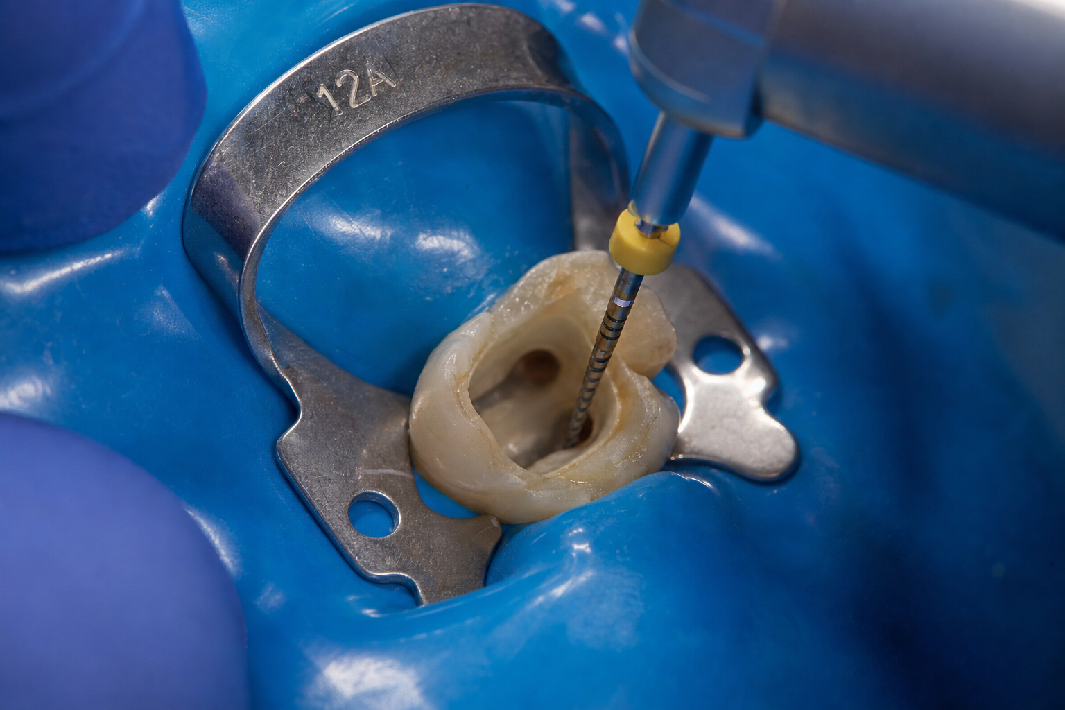 Save your tooth, stop the pain.